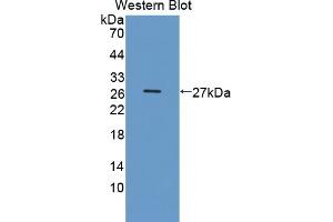 Detection of Recombinant DDC, Human using Polyclonal Antibody to Dopa Decarboxylase (DDC) (DDC Antikörper  (AA 200-420))