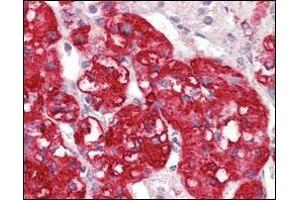 Immunohistochemical analysis of paraffin-embedded human adrenal tissues using STYK1/NOK antibody with DAB staining. (STYK1 Antikörper)