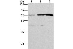 Western Blot analysis of Hela and SKOV3 cell, Mouse liver tissue using ALS2CR11 Polyclonal Antibody at dilution of 1:500 (ALS2CR11 Antikörper)