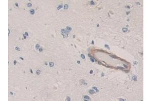 Immunohistochemistry (IHC) image for anti-Cadherin-16 (CDH16) (AA 37-287) antibody (ABIN7434509)