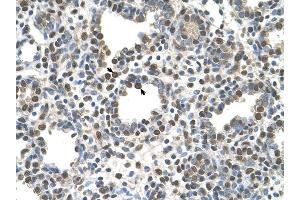 ZDHHC13 antibody was used for immunohistochemistry at a concentration of 4-8 ug/ml to stain Alveolar cells (arrows) in Human Lung.