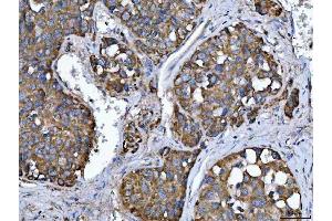 IHC analysis of TMPRSS13 using anti-TMPRSS13 antibody (ABIN7599797). (TMPRSS13 Antikörper  (AA 118-572))
