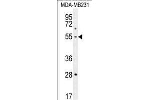 P1 Antibody (Center) (ABIN655817 and ABIN2845241) western blot analysis in MDA-M cell line lysates (35 μg/lane). (MMP1 Antikörper  (AA 317-347))