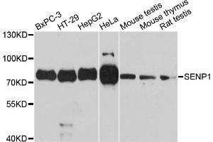 Western blot analysis of extracts of various cell lines, using SENP1 antibody. (SENP1 Antikörper)