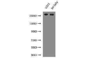 Western Blot Positive WB detected in: U251 whole cell lysate, SH-SY5Y whole cell lysate All lanes: NES antibody at 3 μg/mL Secondary Goat polyclonal to Mouse IgG at 1/10000 dilution Predicted band size: 178 kDa Observed band size: 260 kDa (Nestin Antikörper)