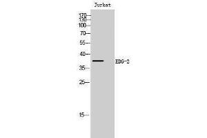 Western Blotting (WB) image for anti-BUD31 Homolog (BUD31) (N-Term) antibody (ABIN3174866) (BUD31 Antikörper  (N-Term))