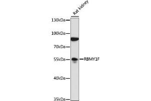 Western blot analysis of extracts of rat kidney, using RBMY1F antibody (ABIN7270095) at 1:1000 dilution. (RBMY1F Antikörper  (AA 1-80))