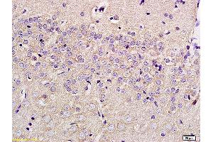Formalin-fixed and paraffin embedded rat brain labeled with Anti-SLC29A4 Polyclonal Antibody, Unconjugated (ABIN754948) at 1:200 followed by conjugation to the secondary antibody and DAB staining (SLC29A4 Antikörper  (AA 401-500))
