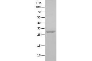 Western Blotting (WB) image for FER Tyrosine Kinase (FER) (AA 1-235) protein (His tag) (ABIN7122905) (FER Protein (AA 1-235) (His tag))