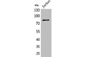 Western Blot analysis of Jurkat cells using PREP Polyclonal Antibody (PREP Antikörper  (N-Term))