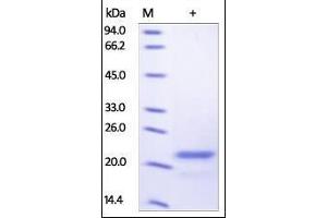 Human Sonic Hedgehog, His Tag on SDS-PAGE under reducing (R) condition. (Sonic Hedgehog Protein (SHH) (AA 24-197) (His tag))