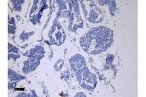 (ABIN7505816) Negative Control showing staining of paraffin embedded Human Testis, with no primary antibody. (ACE2 Antikörper  (N-Term))