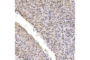 IHC analysis of SSRP1 using anti-SSRP1 antibody (ABIN7600496).