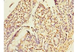 Immunohistochemistry of paraffin-embedded human small intestine tissue using ABIN7155918 at dilution of 1:100