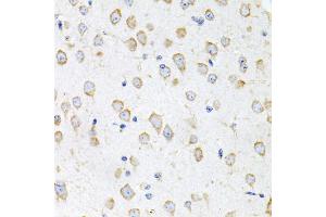 Immunohistochemistry of paraffin-embedded mouse brain using PROK2 antibody (ABIN5975051) at dilution of 1/100 (40x lens). (PROK2 Antikörper)