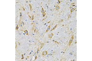 Immunohistochemistry of paraffin-embedded mouse brain using FN1 Antibody (ABIN5975301) at dilution of 1/100 (40x lens).