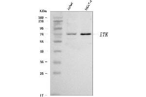 Western blot analysis of ITK using anti-ITK antibody (ABIN7601855).