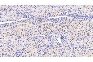 Detection of SIRT3 in Human Kidney Tissue using Polyclonal Antibody to Sirtuin 3 (SIRT3)