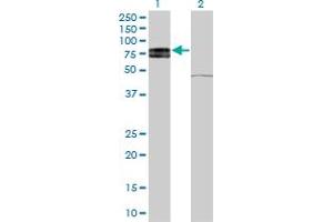 Western Blot analysis of IL22RA1 expression in transfected 293T cell line by IL22RA1 monoclonal antibody (M03), clone 6B5.