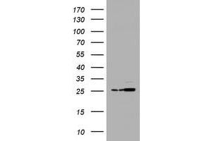 Image no. 2 for anti-Proteasome Subunit alpha 2 (PSMA2) (AA 50-234) antibody (ABIN1491567) (PSMA2 Antikörper  (AA 50-234))