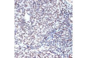 Immunohistochemistry of paraffin-embedded rat ovary using SUN2 Rabbit mAb (ABIN7270135) at dilution of 1:100 (40x lens). (SUN2 Antikörper)