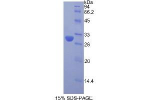 SDS-PAGE analysis of Rat Acrosin Protein. (Acrosin Protein (ACR))