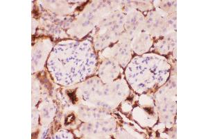Anti-P Glycoprotein Picoband antibody,  IHC(P): Mouse Kidney Tissue (ABCB1 Antikörper  (Middle Region))