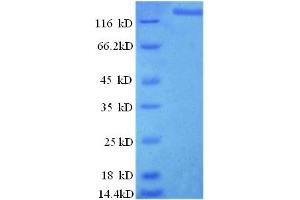 SDS-PAGE (SDS) image for Ligase I, DNA, ATP-Dependent (LIG1) (AA 1-919), (full length) protein (GST tag) (ABIN5709861) (LIG1 Protein (AA 1-919, full length) (GST tag))