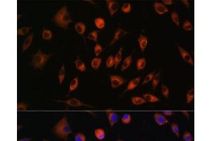 Immunofluorescence analysis of L929 cells using TRIM4 Polyclonal Antibody at dilution of 1:100. (TRIM4 Antikörper)