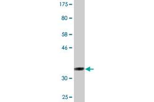 Western Blotting (WB) image for anti-LIM Domains Containing 1 (LIMD1) (AA 577-674) antibody (ABIN522438)