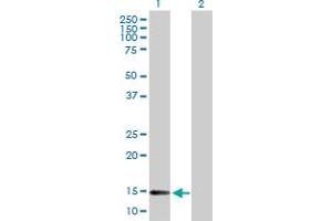 Western Blotting (WB) image for anti-DnaJ (Hsp40) Homolog, Subfamily C, Member 19 (DNAJC19) (AA 1-116) antibody (ABIN530656)