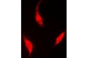 Immunofluorescent analysis of HIWI2 staining in A549 cells. (PIWIL4 Antikörper)