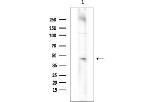 Western blot analysis of lysates from Rat brain, using Phospho-PKM2 (Tyr105) Antibody at 1/1000 dilution.