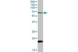 CAMKK2 MaxPab rabbit polyclonal antibody. (CAMKK2 Antikörper  (AA 1-541))