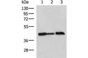 Western blot analysis of A549 Hela and HepG2 cell lysates using PDHA1 Polyclonal Antibody at dilution of 1:750 (PDHA1 Antikörper)