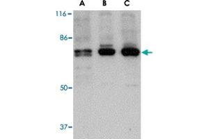 Western blot analysis of PTK7 in (A) human, (B) mouse and (C) rat colon tissue lysate with PTK7 polyclonal antibody  at 1 ug/mL . (PTK7 Antikörper  (N-Term))