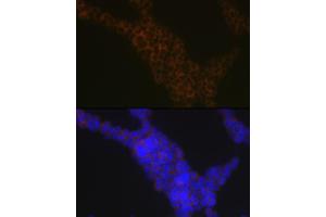 Immunofluorescence analysis of Jurkat cells using LSP1 Rabbit mAb (ABIN7268319) at dilution of 1:100 (40x lens). (LSP1 Antikörper)