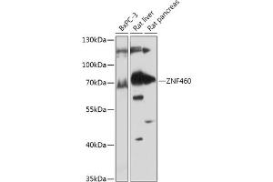 Western blot analysis of extracts of various cell lines, using ZNF460 antibody (ABIN7271490) at 1:1000 dilution. (ZNF460 Antikörper  (AA 100-210))