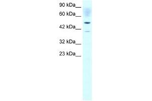 ACAT2 antibody used at 1 ug/ml to detect target protein. (ACAT2 Antikörper)
