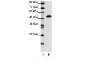 Image no. 1 for anti-Transcriptional Adaptor 3 (TADA3) (N-Term) antibody (ABIN6736139) (TADA3L Antikörper  (N-Term))