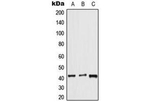Western blot analysis of APJ expression in HeLa (A), mouse lung (B), rat liver (C) whole cell lysates. (Apelin Receptor Antikörper  (Center))
