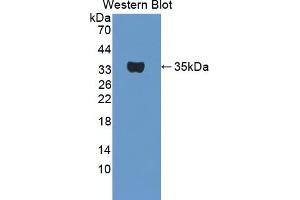 Western blot analysis of the recombinant protein. (TPSB2 Antikörper  (AA 30-276))