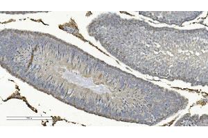 IHC analysis of COX8A using anti-COX8A antibody (ABIN7602820).