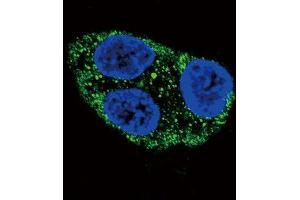 Immunofluorescence (IF) image for anti-Tyrosinase (TYR) antibody (ABIN3003157) (TYR Antikörper)