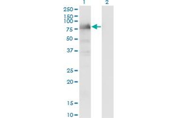 LIMD1 Antikörper  (AA 577-674)