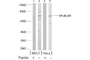 Image no. 1 for anti-Nuclear Factor-kB p65 (NFkBP65) (Ser468) antibody (ABIN197114) (NF-kB p65 Antikörper  (Ser468))