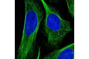 Immunofluorescent staining of human cell line U-2 OS with OFD1 polyclonal antibody  at 1-4 ug/mL dilution shows positivity in cytoskeleton (microtubules).