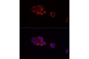 Immunofluorescence analysis of HepG2 cells using Perilipin-2 antibody (ABIN7269220) at dilution of 1:100 (40x lens). (ADRP Antikörper)