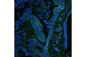 IF analysis of GPX1 using anti-GPX1 antibody (ABIN6719520). (Glutathione Peroxidase 1 Antikörper  (Middle Region))
