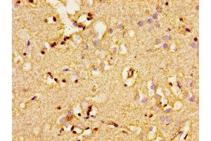 Immunohistochemistry of paraffin-embedded human brain tissue using ABIN7143338 at dilution of 1:100 (ADCY8 Antikörper  (AA 534-670))